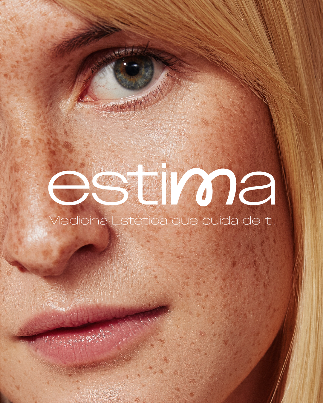 Estima